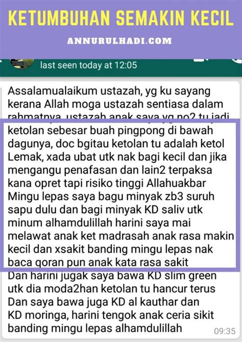 ketumbuhan semakin kecil annurulhadi