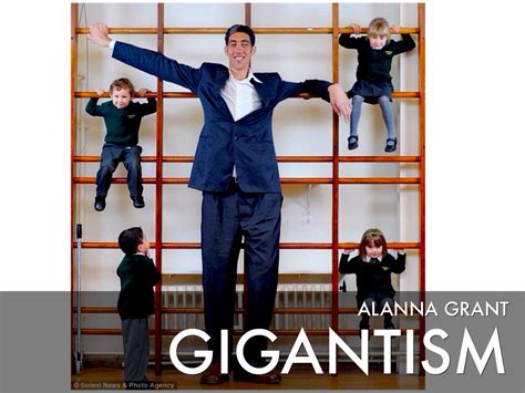 gigantism gigantism by alanna grant we ll explain the causes of
