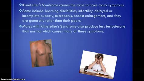 Klinefelters Syndrome Youtube