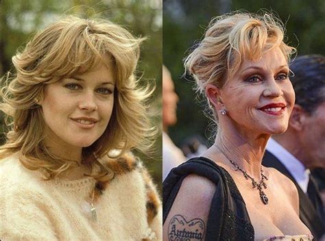 20 Worst Cases Of Celebrity Plastic Surgery Gone Wrong