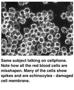 cellphones change red blood cells listen   gut