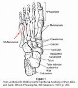 Bone Fracture Metatarsal Sheets Tendons Fifth Ligaments Wickedbabesblog sketch template
