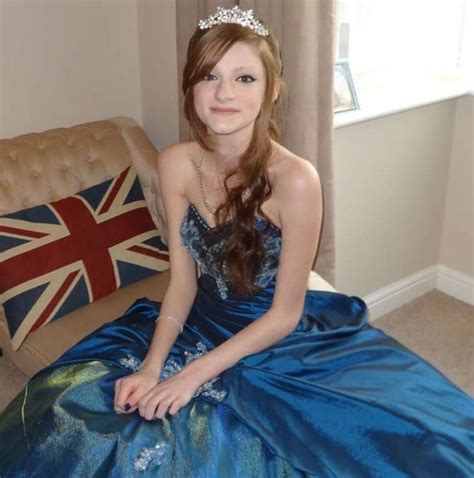 Heartbreaking Picture Shows Beautiful Smile Of Prom Girl Ravaged By