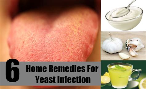 home remedies for oral yeast infections xxx porn library
