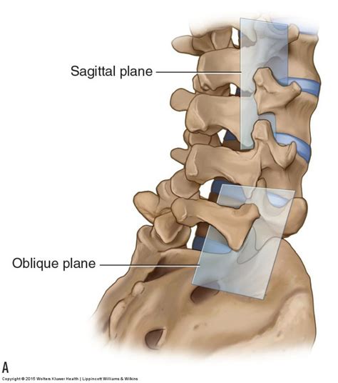 understanding degenerative spine conditions  symptoms