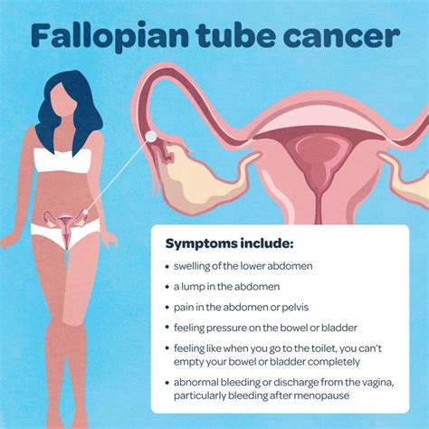 fallopian tube cancer statistics symptoms treatment