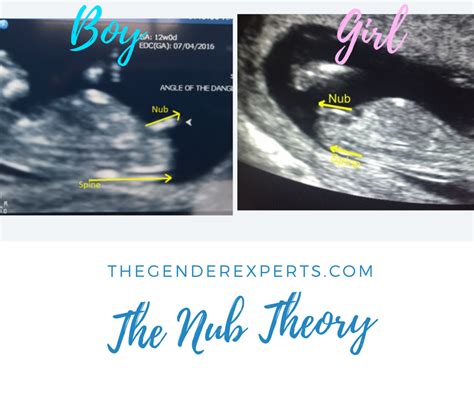 The Gender Experts Ultrasound Gender Prediction Submit