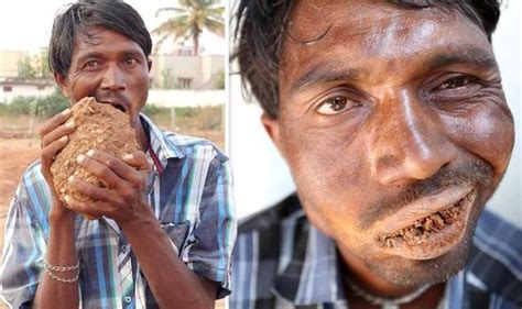 video man with bizarre eating disorder eats three kilos of bricks