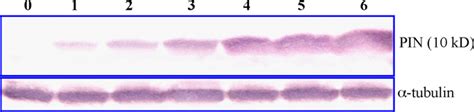 Western Blotting Analysis Of Expression Of The Grouper Pin Protein In