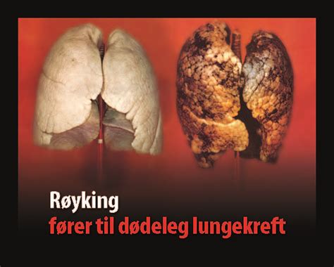 Norway Tobacco Labelling Regulations