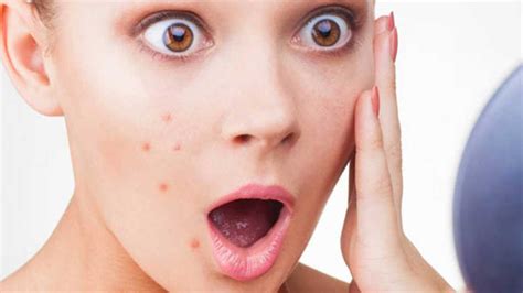 reasons that cause pimples the health blog fidoc