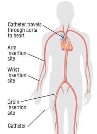 cardiac catheterization virtual heart failure clinic