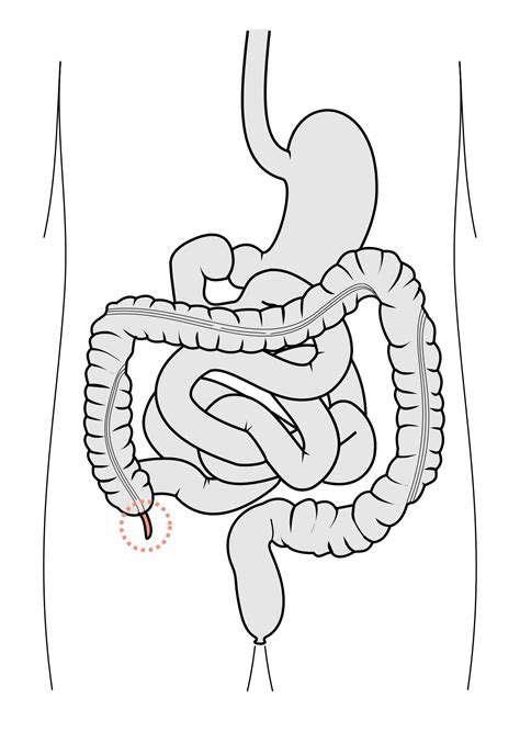 vermiform appendix wiktionary   dictionary