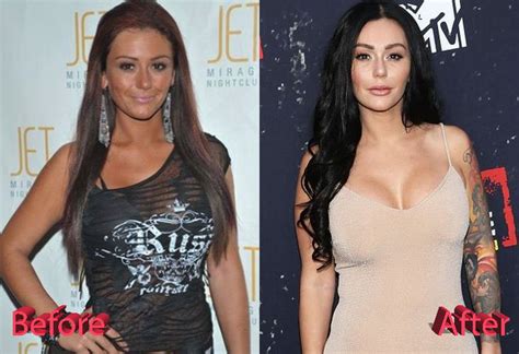 larsa before plastic 💖jwoww before and after plastic surgery