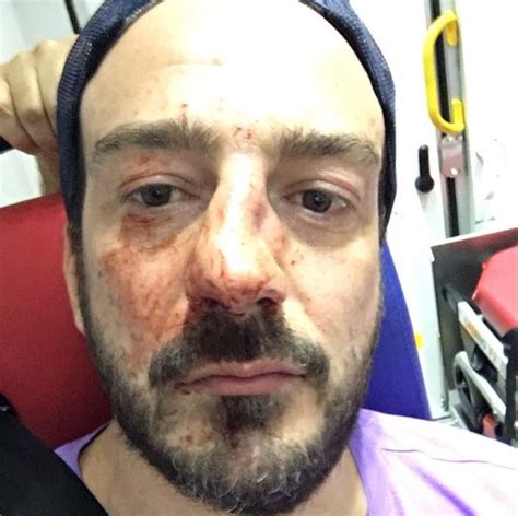 flipboard gay rights activist beaten up in homophobic attack in france