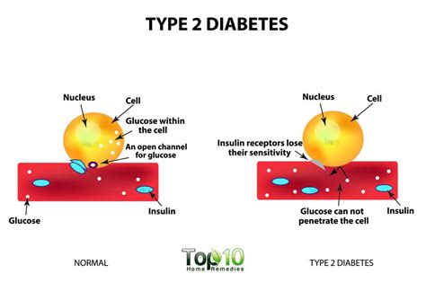 case diagram  diabetes detection