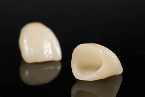 full ceramic crowns cosmetic dentistry dental treatments
