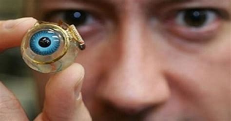 bionic eye implant  fight absolute blindness technology vista