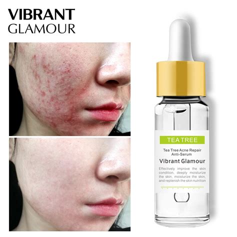 vg tea tree acne treatment serum blackhead shrink pores skin care repair acne marks scar face