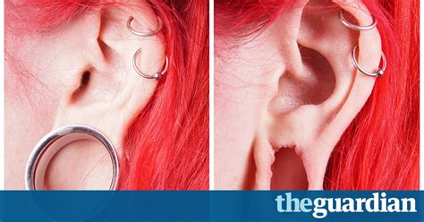 Big Increase In Surgery To Mend ‘flesh Tunnel’ Earlobes Life And