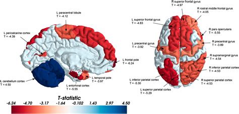 Sex Differences In The Structural Connectome Of The Human Brain Pnas