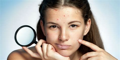 spots dry and oily skin how hormones affect your skin before and during period