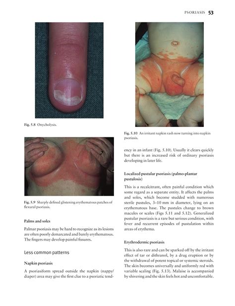 Medicine By Sfakianakis G Alexandros Skin Disease In