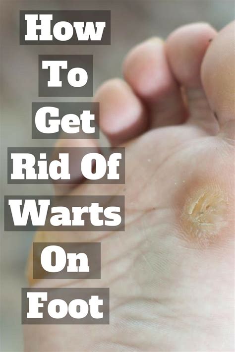 how to get rid of warts on your skin full body wart remover and scar treatment with images