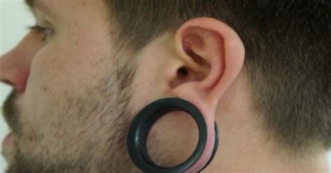 cosmetic surgery  fix ear tribal piercings   rise cbs news