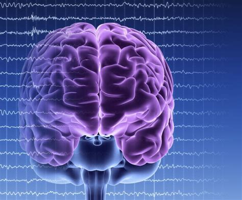 Multiple Sclerosis Linked To Increased Risk For Epilepsy