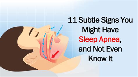 11 Subtle Signs You Might Have Sleep Apnea And Not Even