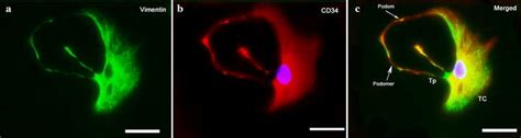 representative double labeled immunofluorescence identification  tcs  scientific