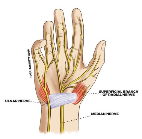 wrist  hand  labeled   diagram  shows