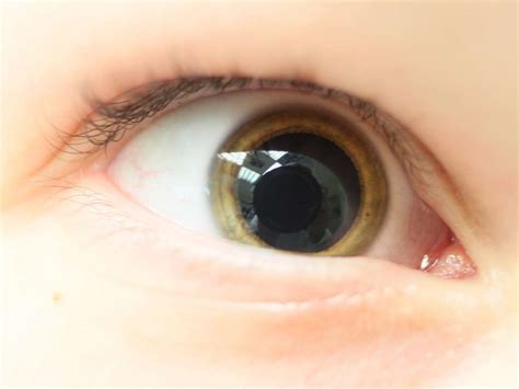 mydriasis   treatment  dilated pupils