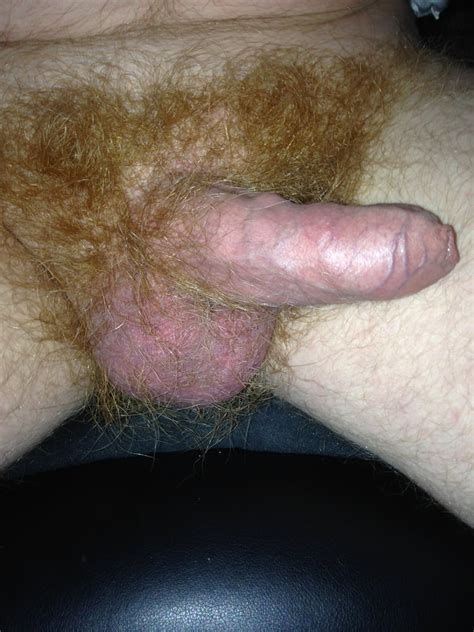 Hairy Ginger Cock 6 Pics Xhamster