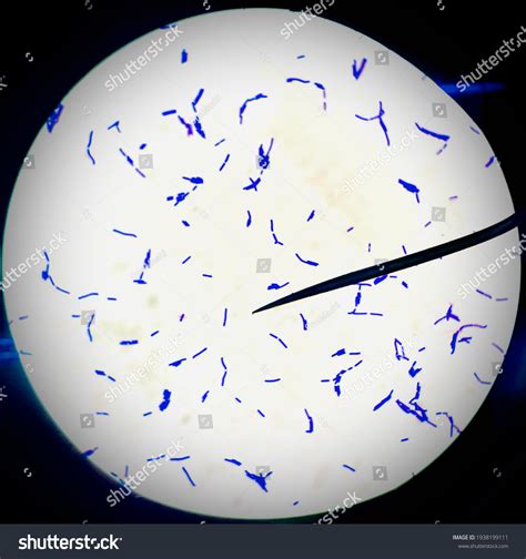 bacilli grampositivo bacillus cereus foto de stock