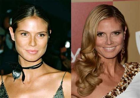 heidi klum nose job before and after plastic surgery and photoshop pinterest more best