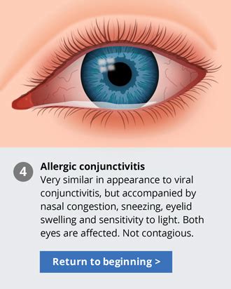 pink eye facts identify symptoms  treat pink eye