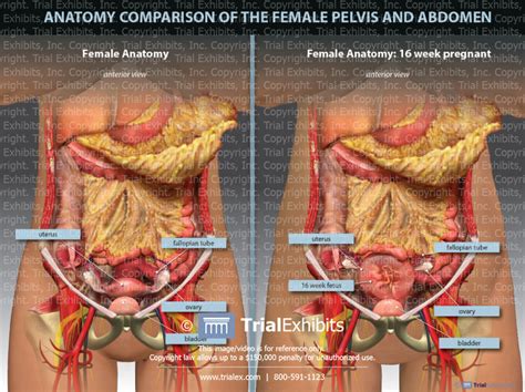 Female Pelvis And Abdomen Comparison Trialexhibits Inc