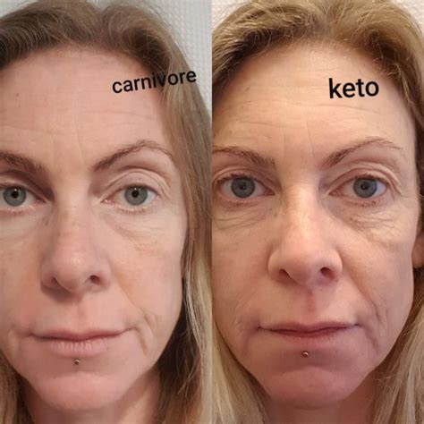 carnivore diet success story transformation with Tani