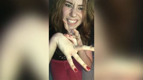 Woman With Bizarre Joint Hypermobility Can Bend Her Fingers All The