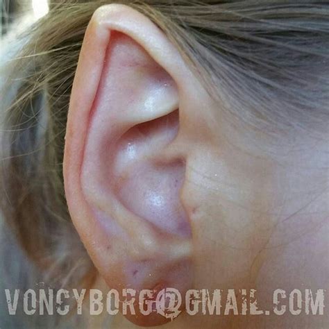 healed ear pointing by samppa von cyborg body
