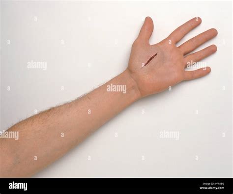 deep cut  palm  hand stock photo alamy