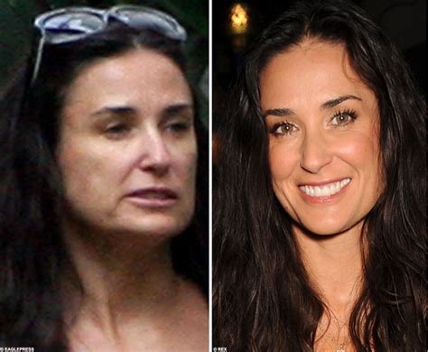 Demi Moore Plastic Surgery Before After Plastic Surgery