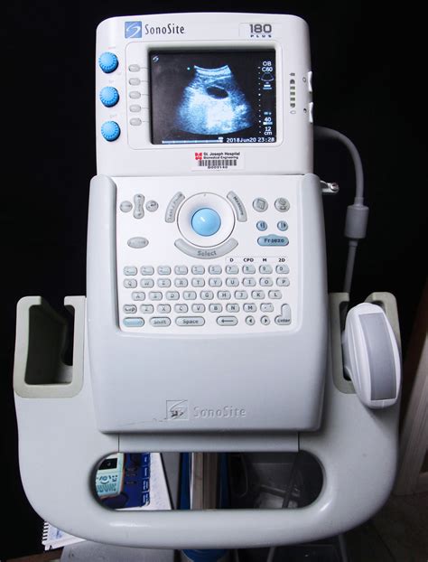 sonosite   portable ultrasound