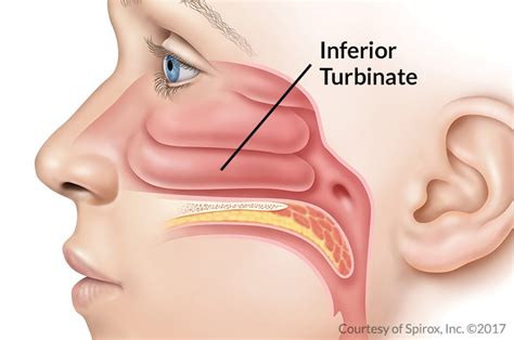 nasal turbinate enlargement congestion nevada sinus relief