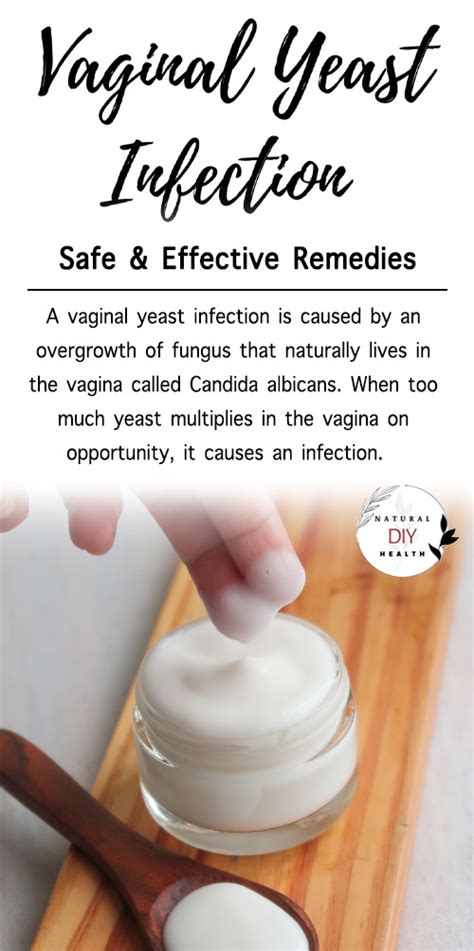 vaginal yeast infection remedies natural and safe naturaldiyhealth