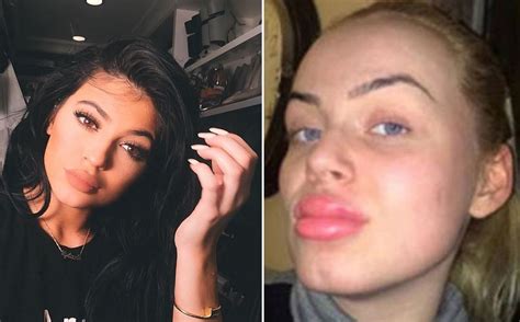 kylie jenner challenge teens are using bottle tops to get kylie jenner