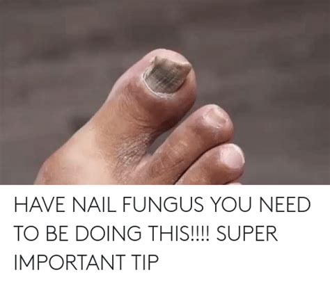 🔥 25 Best Memes About Nail Fungus Nail Fungus Memes