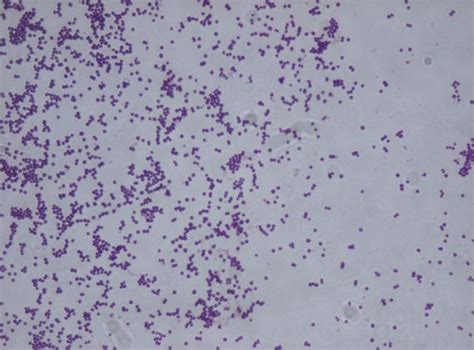 Staphylococcus Saprophyticus Medical Laboratories